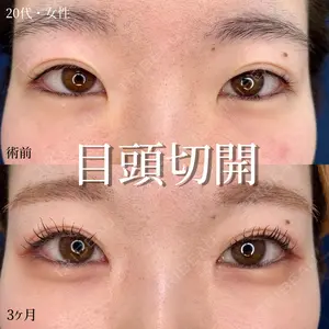 before image