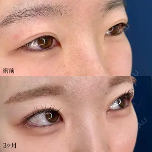 90 days after image
