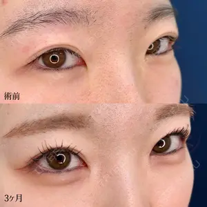 90 days after image