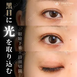 90 days after image