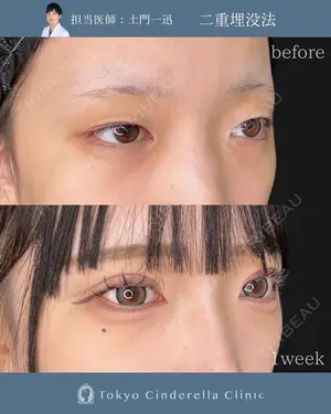 before image