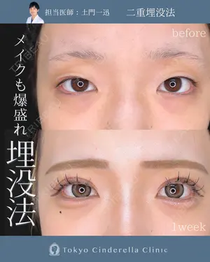 7 days after image