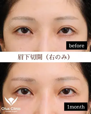 30 days after image