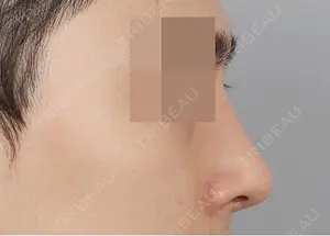30 days after image