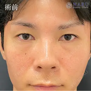 before image