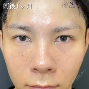 31 days after image