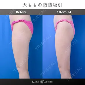 null days after image