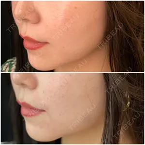 0 days after image
