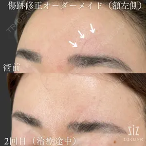 before image