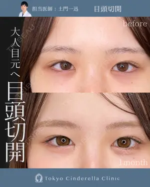 30 days after image