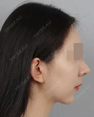 30 days after image