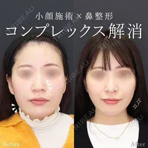 180 days after image