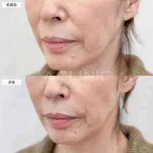 0 days after image