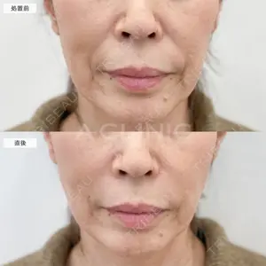 0 days after image