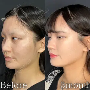 90 days after image