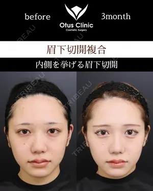 before image