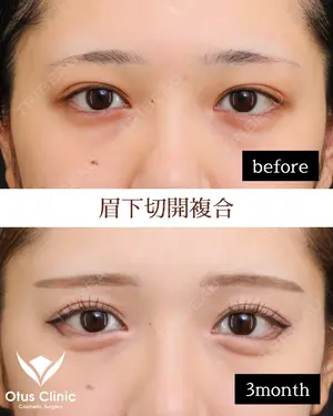 90 days after image