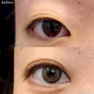 before image