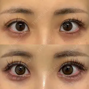 before image