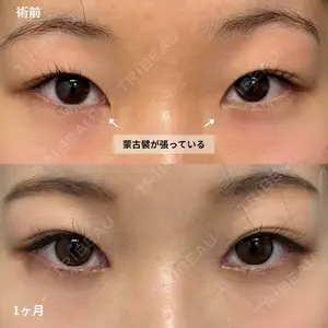 before image