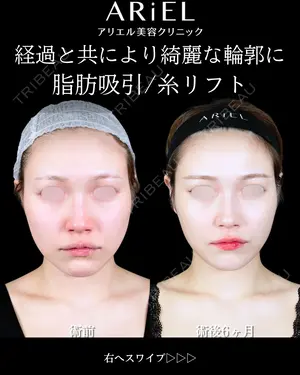 180 days after image