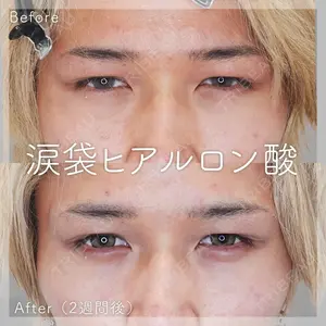 before image