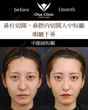 30 days after image