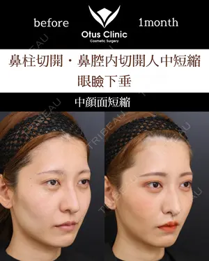 30 days after image