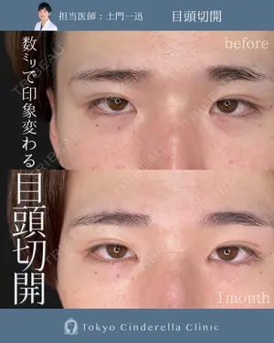 30 days after image