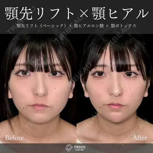before image