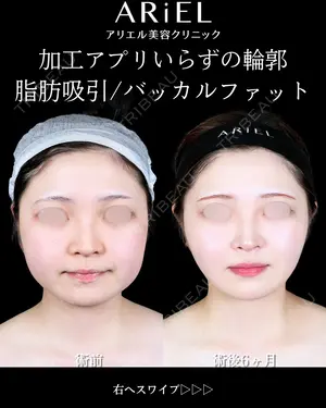 180 days after image
