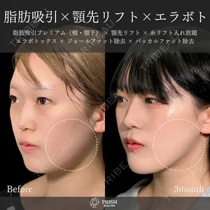 30 days after image