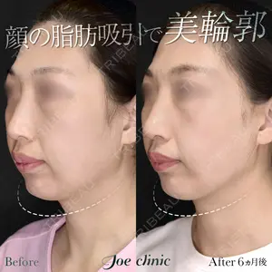 180 days after image