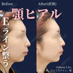 0 days after image