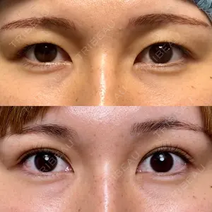 30 days after image
