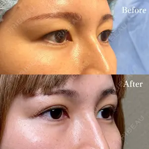 30 days after image