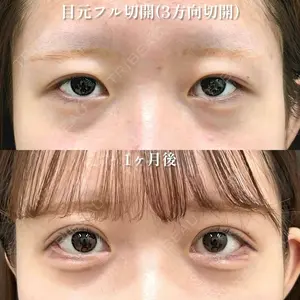 30 days after image