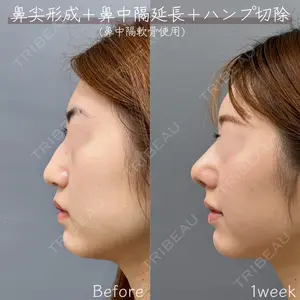 7 days after image