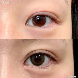 before image