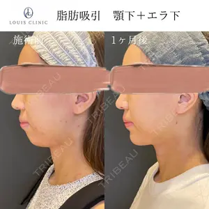 30 days after image