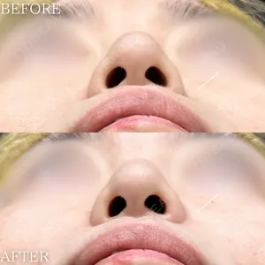 before image