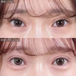 60 days after image