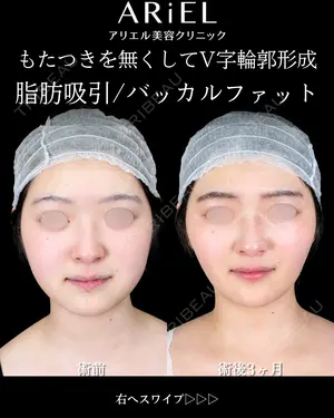90 days after image