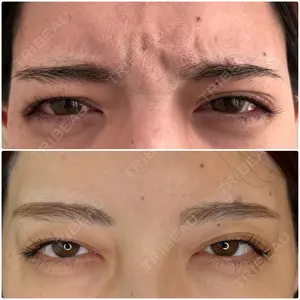 14 days after image