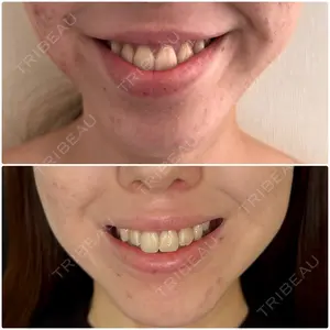 14 days after image