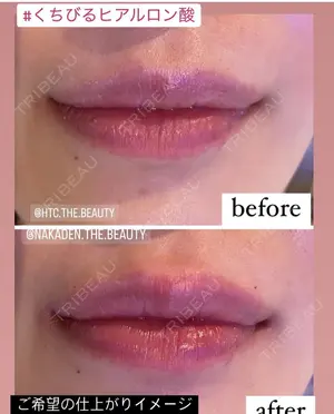 null days after image