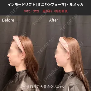 before image