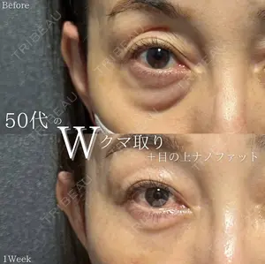 7 days after image