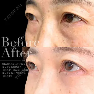 90 days after image