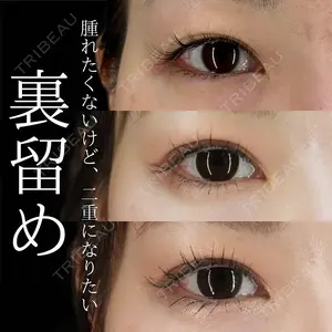 30 days after image